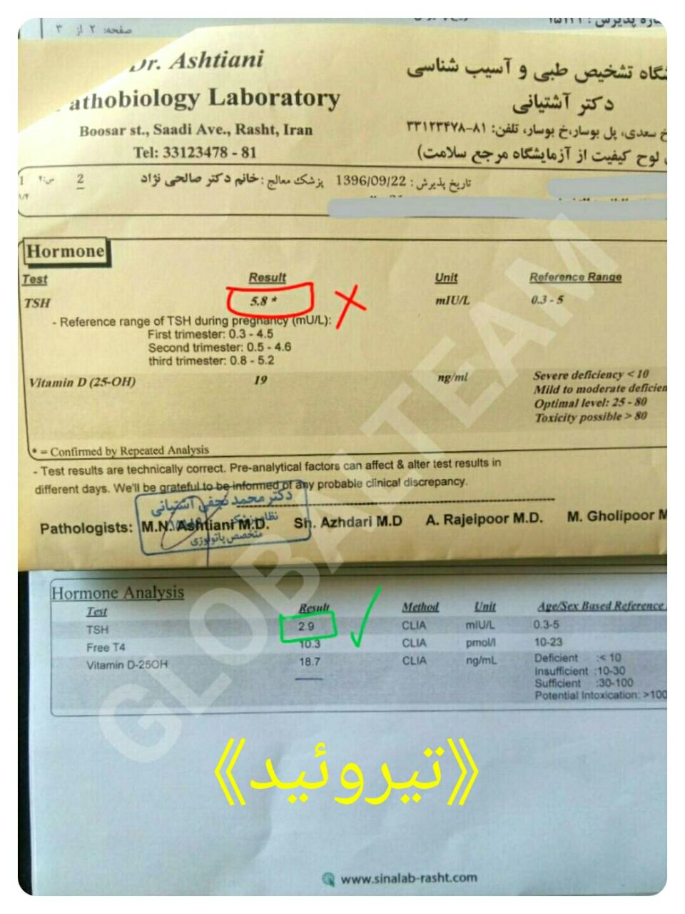 قهوه های گانودرما و خواص بینظیرشان