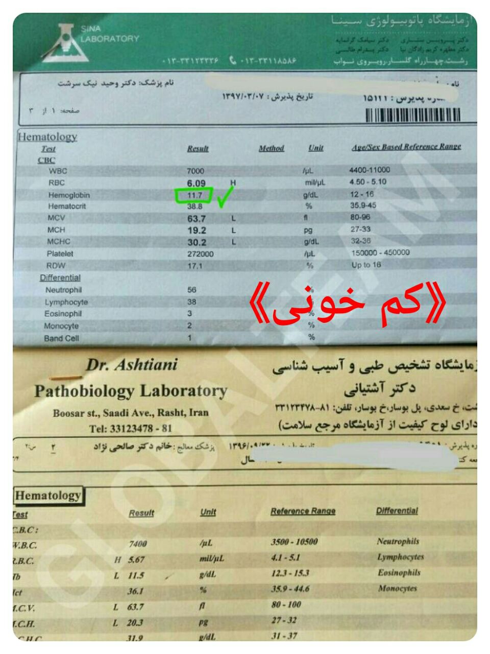 قهوه های گانودرما و خواص بینظیرشان